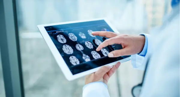 Artificial Intelligence in Healthcare: Innovation and Competitive Advantage 